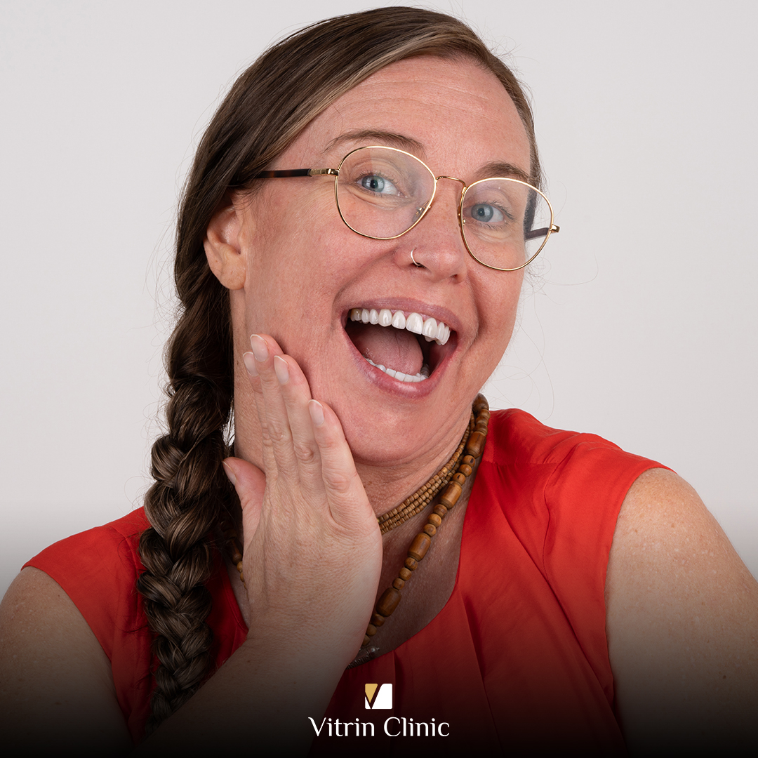 Minimal Prep Veneers :The Conservative Way to a Natural Smile